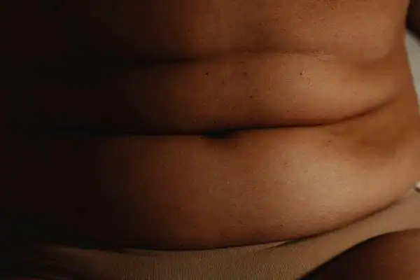 The Hidden Connection: How Stress Shapes Your Fitness and Body Composition 3 image of what stress can do on the stomach area and how Lipo 360 Rugby can help to change your body shape.